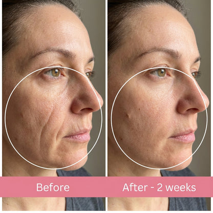 Anti Wrinkle Pillow + Pillowcase Bogo kaching